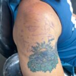 Tatuador Anderson cobertura antes copacabana